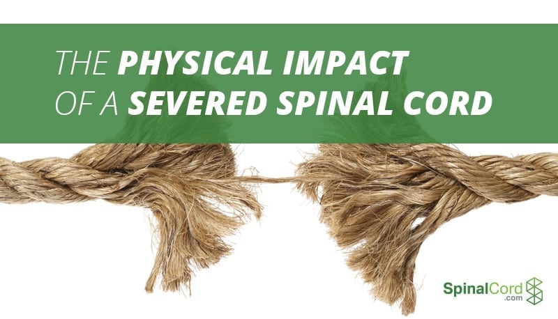 what happens next the physical impact of a severed spinal cord severed spinal cord