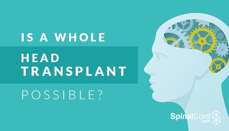 is brain transplant possible is neurological transplant possible