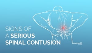 Signs-of-a-spinal-contusion-title-image