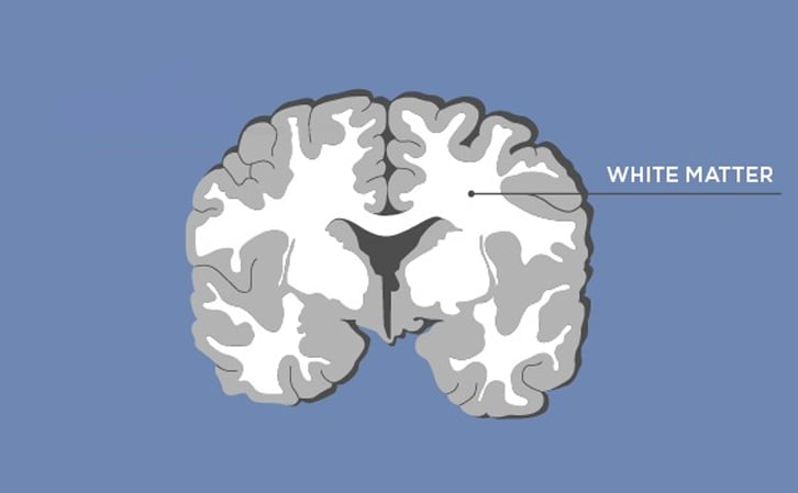 Where-White-Matter-is-Located-in-the-Brain