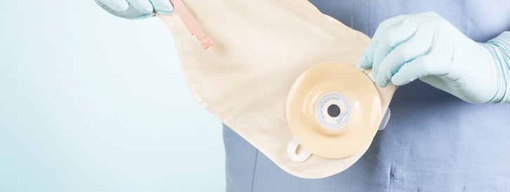 People with Spinal Cord Injury on Colostomy