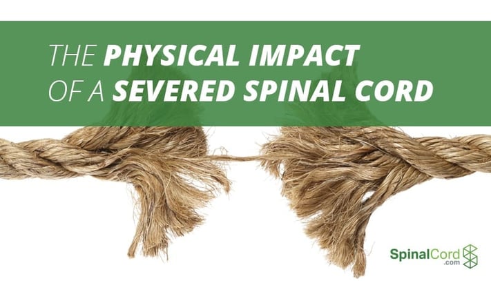 The Physical Impact of a Severed Spinal Cord