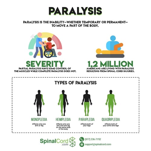 types of paralysis-infographic