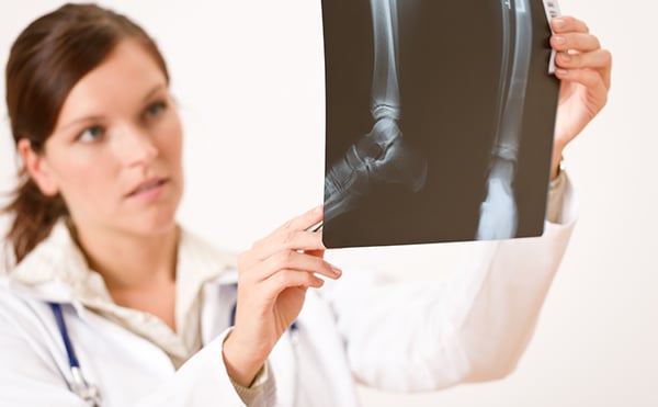 female doctor checking x-ray