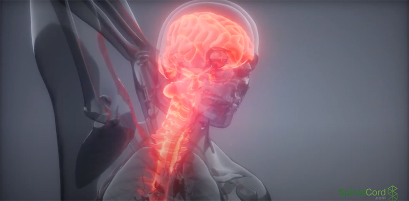 spinal-cord-injuries-video-min
