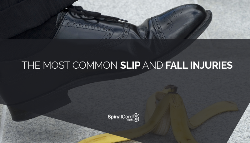 The-Most-Common-Slip-and-Fall-Injuries-Blog-IMG-1.png
