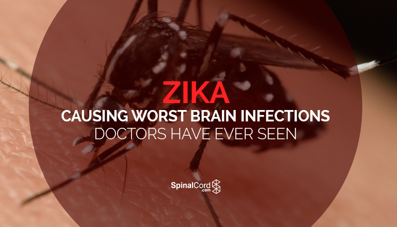 Zika-Causing-Worst-Brain-Infections-Doctors-Have-Ever-Seen-Blog-IMG.png