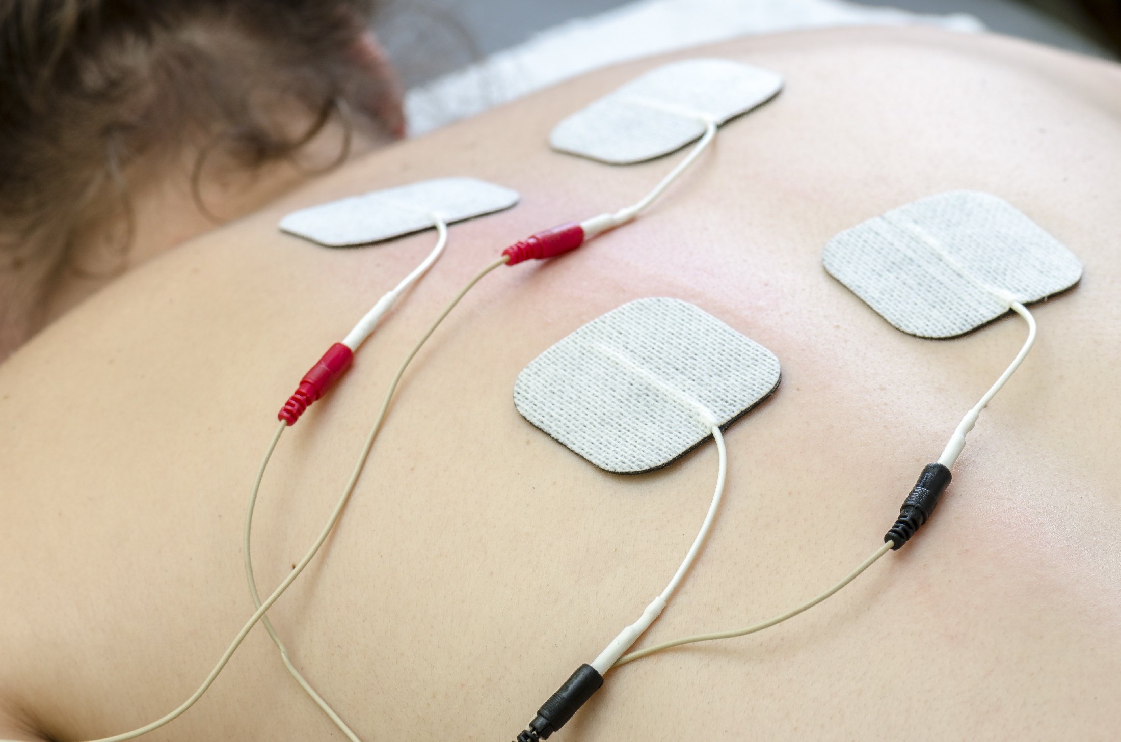 What Is Electrical Muscle Stimulation? - Spine & Rehabilitation Centers
